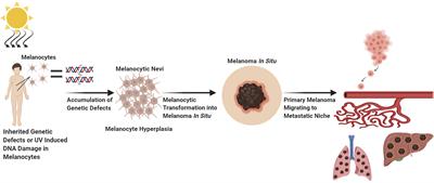 Decoding Melanoma Development and Progression: Identification of Therapeutic Vulnerabilities